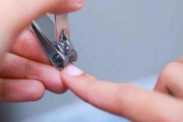指甲黑色竖纹严重吗 指甲黑色竖纹是癌症吗?指甲有竖纹是灰指甲吗-第15张图片-波音达百科