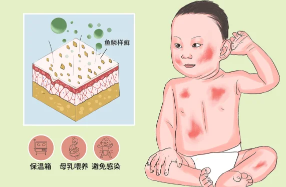 火棉胶婴儿是什么原因造成的 如懿传怪胎图片火棉胶婴儿-第11张图片-波音达百科