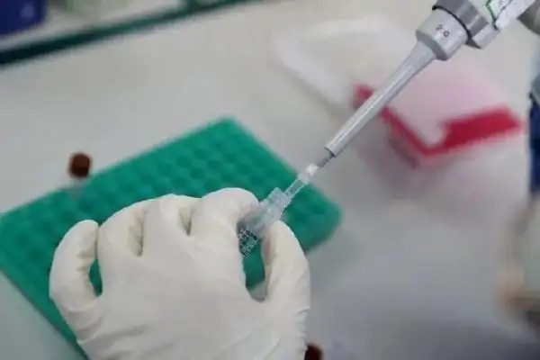 什么蛇能打败眼镜王蛇(眼镜王蛇最怕什么动物)-第8张图片-波音达手游百科