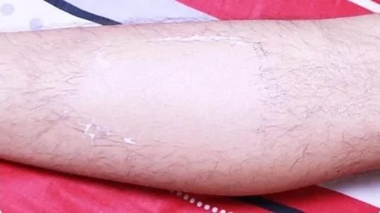 芝麻女孩恶心原图电影名叫什么 和玉米男孩是真的吗-第6张图片-波音达百科