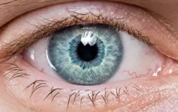 狮子什么瞳孔颜色最稀有?世界十大最稀有瞳孔颜色-第3张图片-波音达手游百科