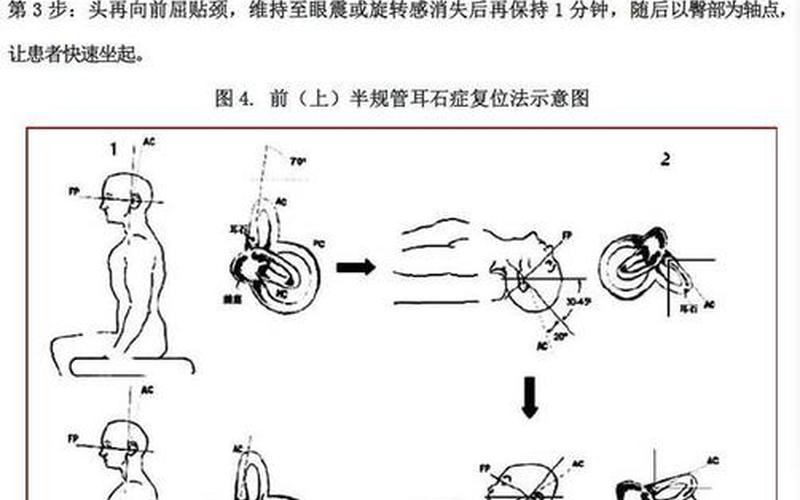 耳石症快速自愈 *** -第1张图片-波音达百科