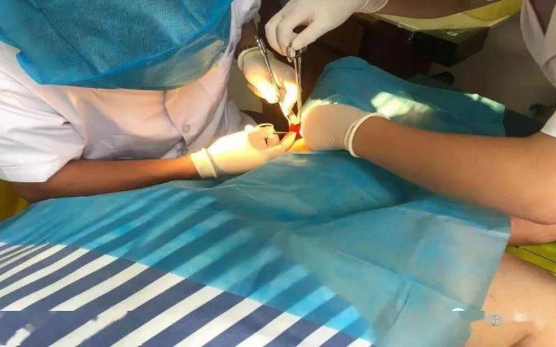 最尴尬的手术是什么-第1张图片-波音达百科