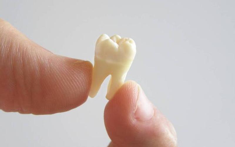 拔完牙多久能献血-第1张图片-波音达百科