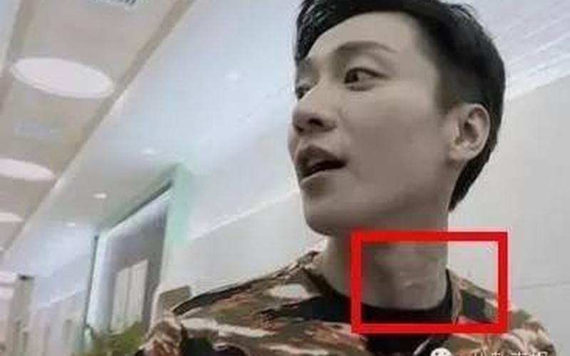 乔任梁现场图血手臂-第1张图片-波音达百科