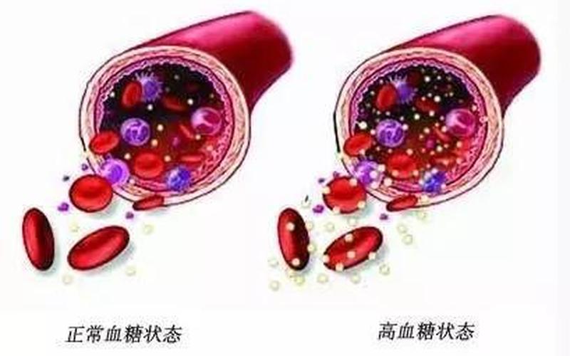 三高老人不吃肉能降血脂吗-第1张图片-波音达手游百科