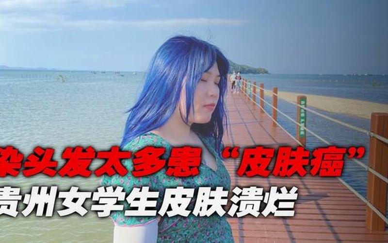 谢霆锋患皮肤癌曝真情2020-第1张图片-波音达百科