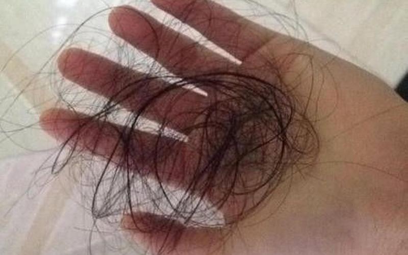 乌师发宝防脱育发液-第1张图片-波音达百科