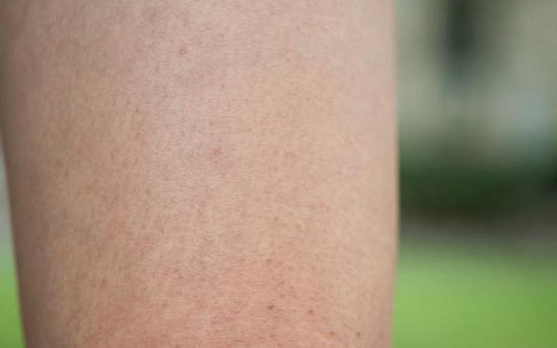 天津皮肤病专科医院-第1张图片-波音达百科