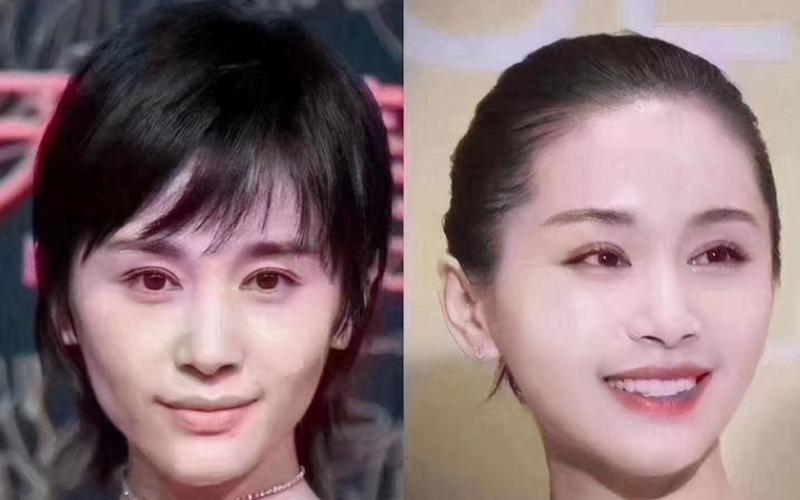 王子文变样被疑整容-第1张图片-波音达百科