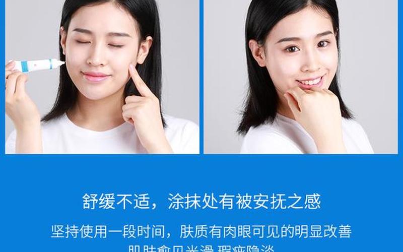 wis祛痘印净化凝胶-第1张图片-波音达手游百科