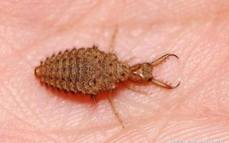 那种动物天生高血压-第1张图片-波音达百科