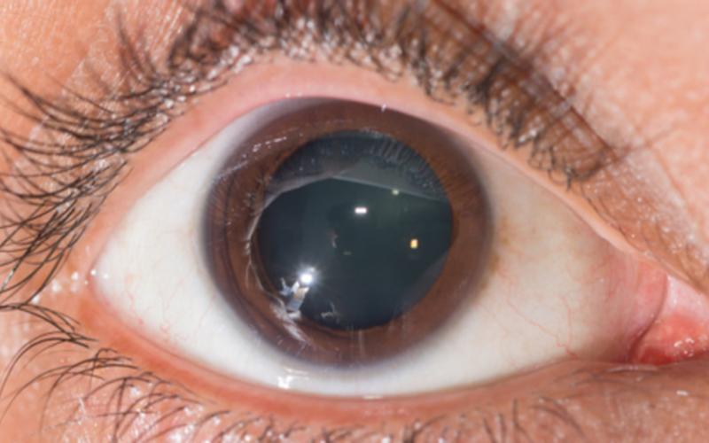 遇到喜欢的人瞳孔放大-第1张图片-波音达百科