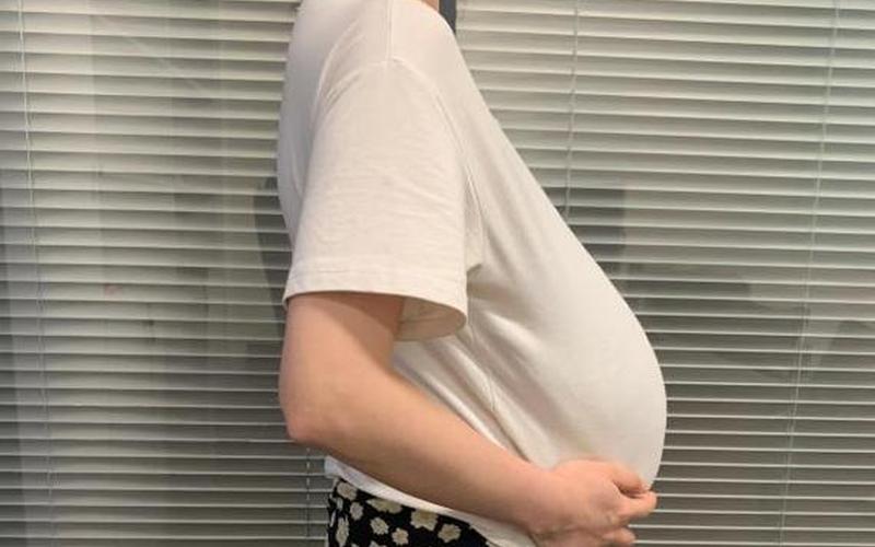 24岁女孩入职体检查出少一个肾-第1张图片-波音达百科