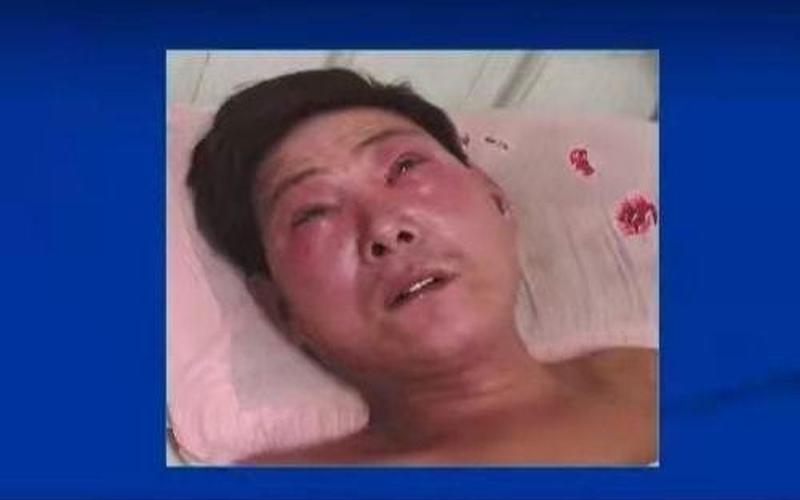 西安为什么会爆发出血热-第1张图片-波音达手游百科
