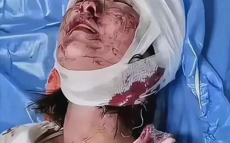 唐山打人案受害人：没有被车碾压-第1张图片-波音达百科