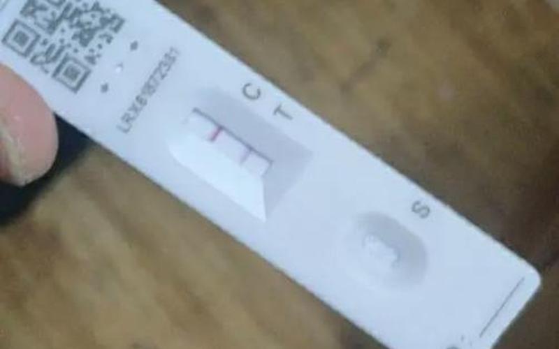 感冒一检查抗原就是阳性-第1张图片-波音达百科