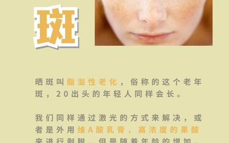 怎样祛斑效果更好-第1张图片-波音达百科
