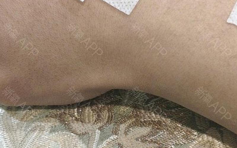 21天包含打针当天么-第1张图片-波音达百科