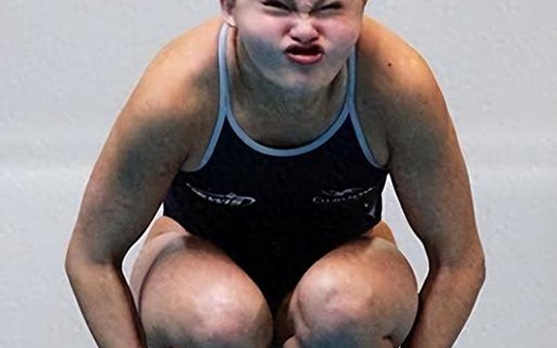 北京激光脱毛多少钱-第1张图片-波音达百科