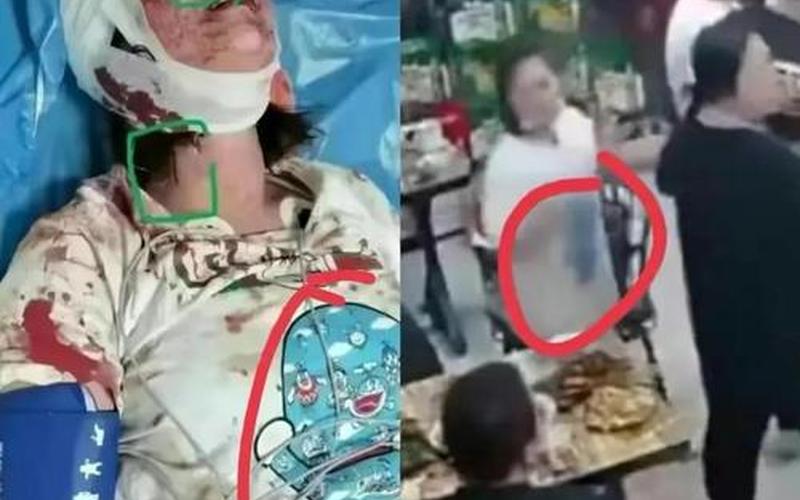 唐山打人案女子死亡-第1张图片-波音达百科