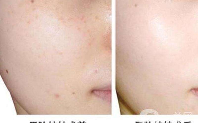 做黑脸娃娃哪里好-第1张图片-波音达百科