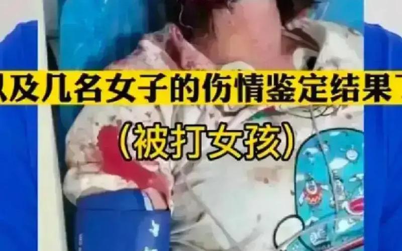 唐山打人女子最新消息死亡照片曝光-第1张图片-波音达百科