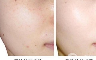 做黑脸娃娃哪里好