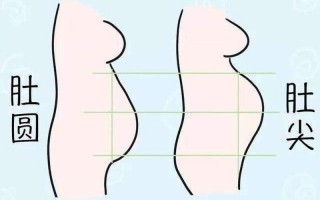 妊娠纹判断生男生女