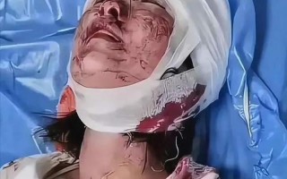 唐山打人案受害人：没有被车碾压