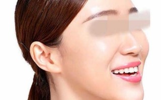 额部除皱整形的医院