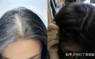 头发少怎么增加发量