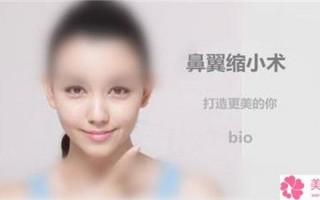 黑脸娃娃价格是多少