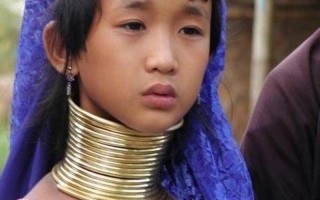 非洲象人族真实照片