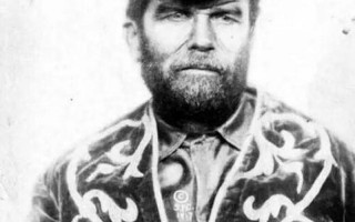 没有毛发的墨西哥人