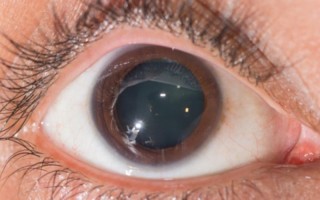 遇到喜欢的人瞳孔放大