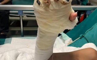 世界上最丑的腿图片