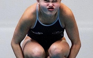 北京激光脱毛多少钱