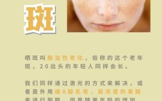 怎样祛斑效果更好
