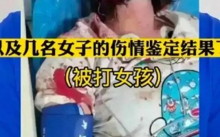 唐山打人女子最新消息死亡照片曝光