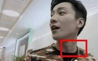 乔任梁现场图血手臂