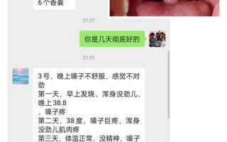 新冠咽喉痛和普通咽喉痛区别