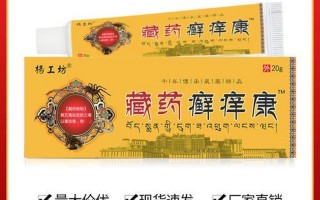 癣见康可以治什么