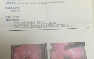 无症状阳性3天能转阴吗