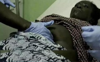 尼日利亚不明疾病