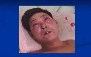 西安为什么会爆发出血热