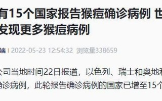 江苏猴痘病例已增至57例