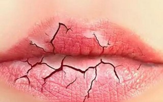 嘴唇越舔越容易干裂