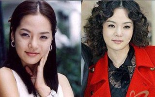 韩国明星整容失败