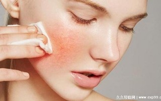 为什么医生不建议涂防晒霜